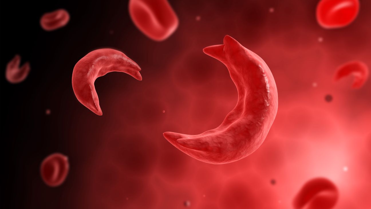 Tribal Ministry Organises Conclave for Awareness of Sickle Cell Disease